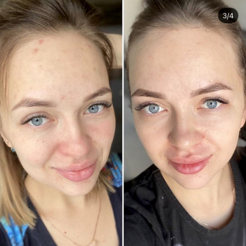 Максидент beauty, Оренбург Фото - 6