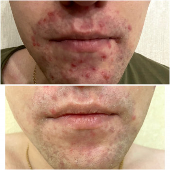 Максидент beauty, Оренбург Фото - 11