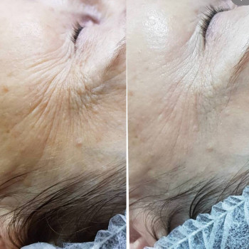 Алина Резаненко, Yekaterinburg Фото - 6