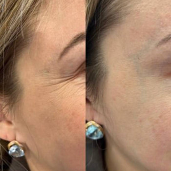 Наталья Коваленко, Екатеринбург Фото - 5