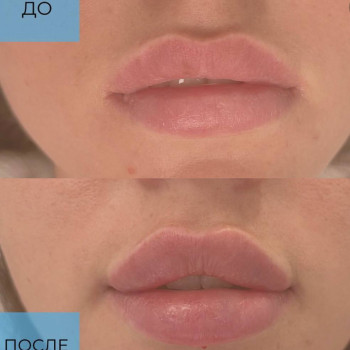 Екатерина Макеева, Yekaterinburg Фото - 5