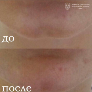 Наталья Третьякова, Yekaterinburg Фото - 6