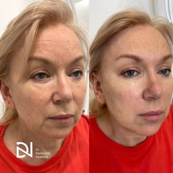 Надежда Дятлова, Moscow Фото - 5