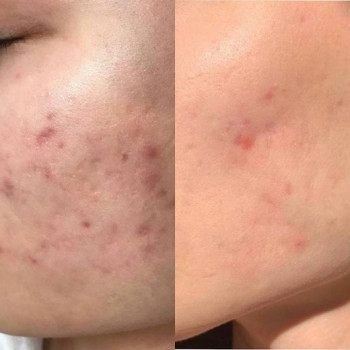 Мария Шацкая, Moscow Фото - 5