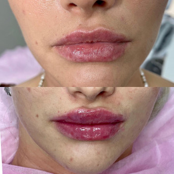 Зарина Хетагурова, Moscow Фото - 5