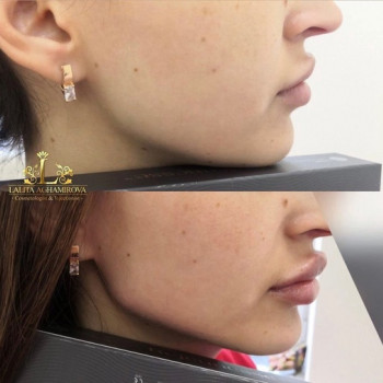 Лалита Агамирова, Moscow Фото - 5