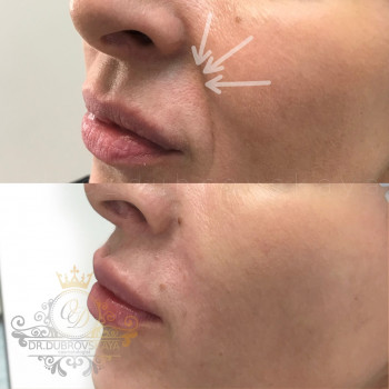 Ольга Дубровская, Moscow Фото - 5