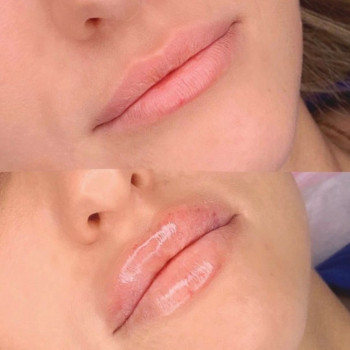 Гаяне Чопикян, Moscow Фото - 5