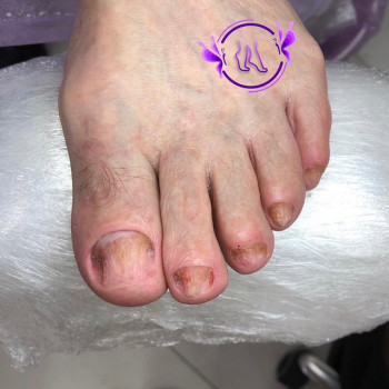 Камета Авторханова, Москва Фото - 5