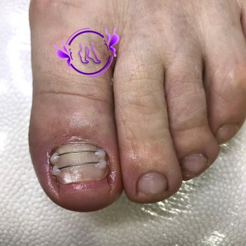 Камета Авторханова, Москва Фото - 6