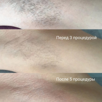 Бьюти Мед Клиник, Moscow Фото - 5