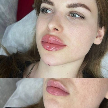 Love Your Body, Moscow Фото - 5