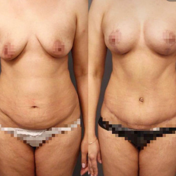 Наталия Нудельман, Yekaterinburg Фото - 5