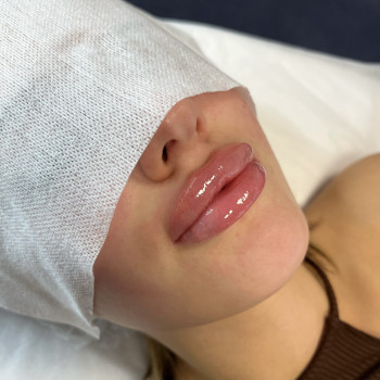 Контурная пластика губ 
                    Cosmetologist Lidiia Komkova Warsaw