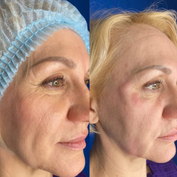 Клиника Счастья, Yekaterinburg Фото - 5