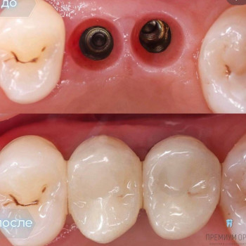 Премиум Орто, Yekaterinburg Фото - 5