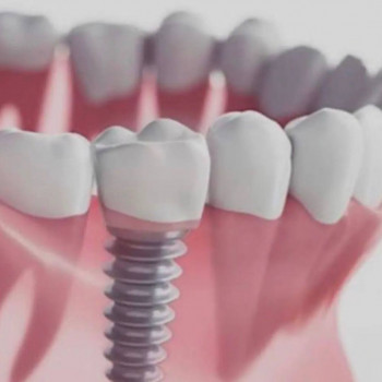 Сlever dent, Yekaterinburg Фото - 5