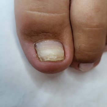 Флюра Мананникова, Orenburg Фото - 5