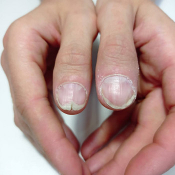 Флюра Мананникова, Orenburg Фото - 7