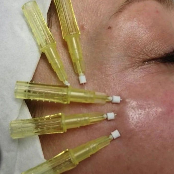 Любовь Дубчак, Москва Фото - 5