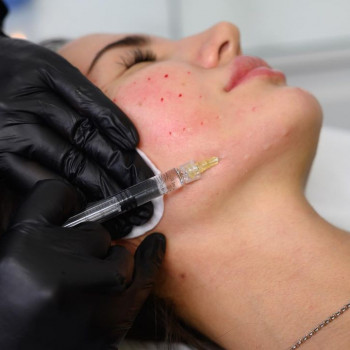 Жанна Мамакаева, Москва Фото - 5