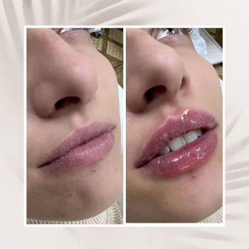 Олеся , Москва Фото - 5