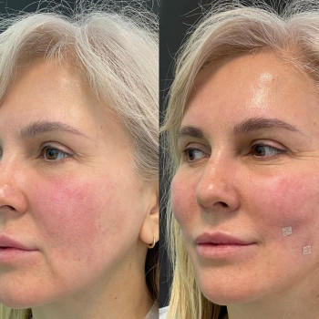 Марина Абдуризаева, Moscow Фото - 6