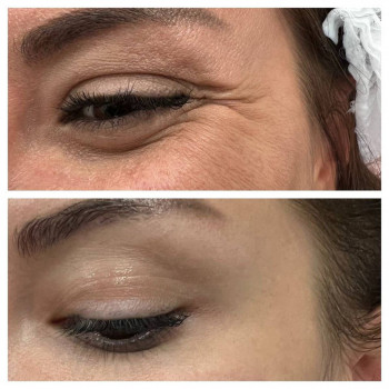 Замира Нурмагомедова, Moscow Фото - 5