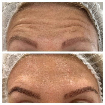 Замира Нурмагомедова, Moscow Фото - 6