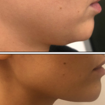 Алена Саакян, Moscow Фото - 5