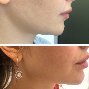 Алена Саакян, Moscow Фото - 6