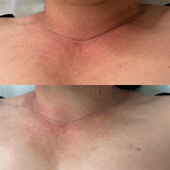 Малика Шухаибова, Moscow Фото - 5