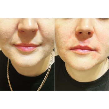 Альбина Исрафилова, Moscow Фото - 5