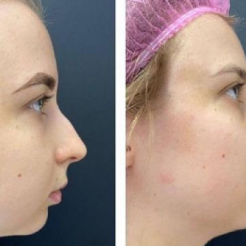 Ольга Каррерас, Moscow Фото - 5