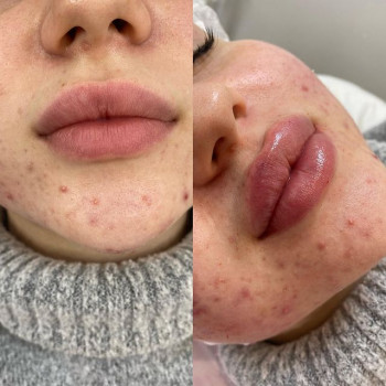 Аниса , Moscow Фото - 6