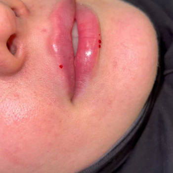 Зазу Курбанова, Moscow Фото - 5