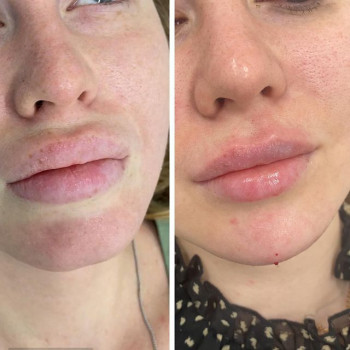 Амина Бердова, Moscow Фото - 5