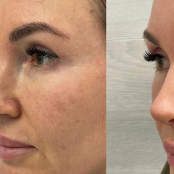 Валентин Андреевич Абрамов, Novosibirsk Фото - 5