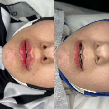 Хадижа , Moscow Фото - 5