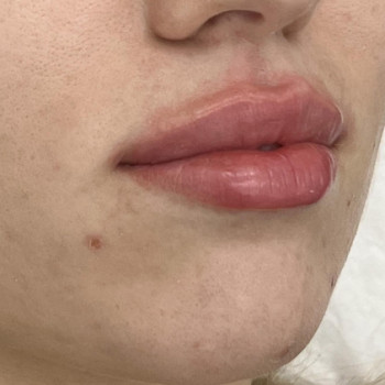 Ксения Осинская, Moscow Фото - 5