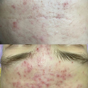 Раисат Исмаилова, Moscow Фото - 5