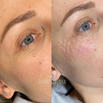 Фатима Габуаева, Moscow Фото - 6