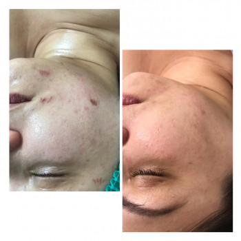 Olesya Dovhanych, Kladno Фото - 6