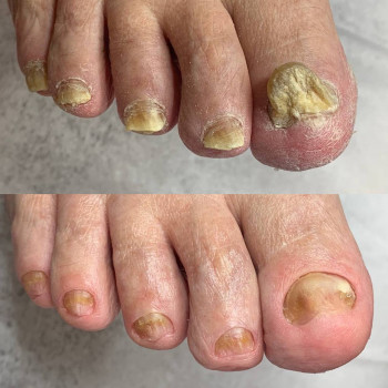 Центр Аппаратного Педикюра, Volgograd Фото - 7