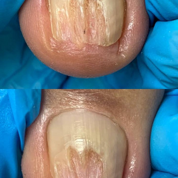 Центр Аппаратного Педикюра, Volgograd Фото - 11