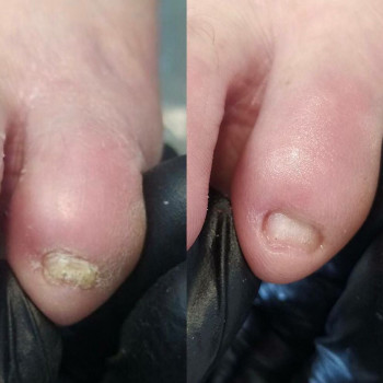 Центр Аппаратного Педикюра, Volgograd Фото - 13