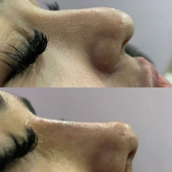 Сувара Хибиева, Moscow Фото - 6