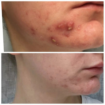 Лана Квачахия, Moscow Фото - 5