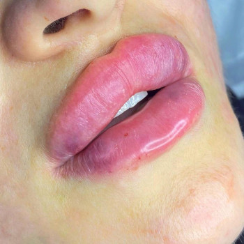 Анастасия Волкова, Moscow Фото - 5