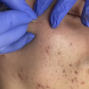 Анастасия Волкова, Moscow Фото - 6